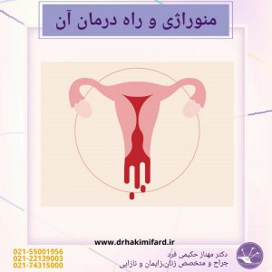 Read more about the article منوراژی یا هایپر منوره